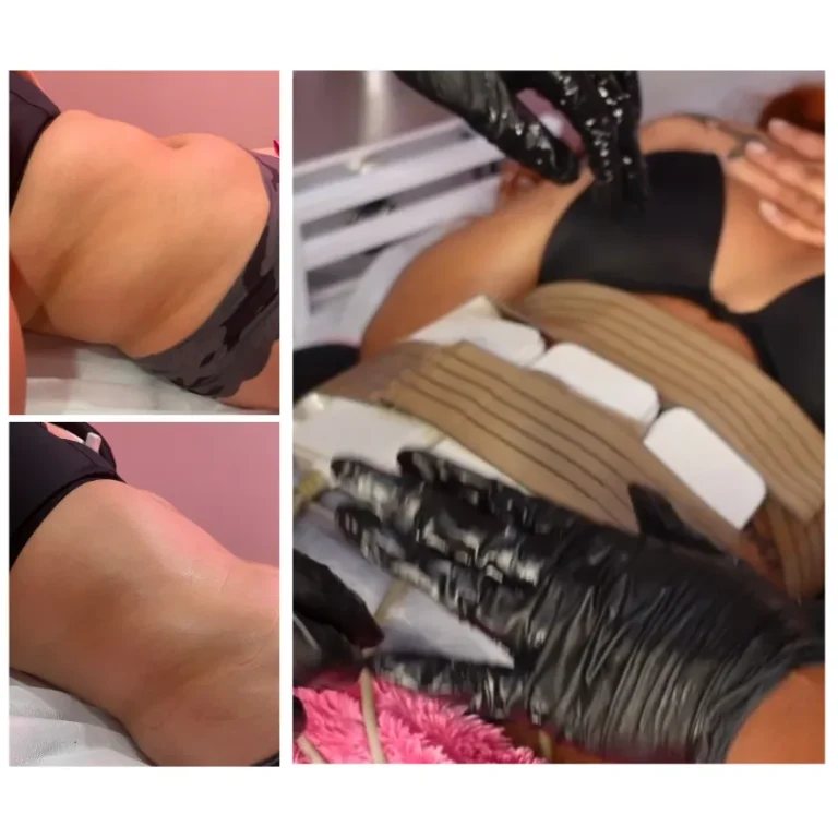 body sculpting