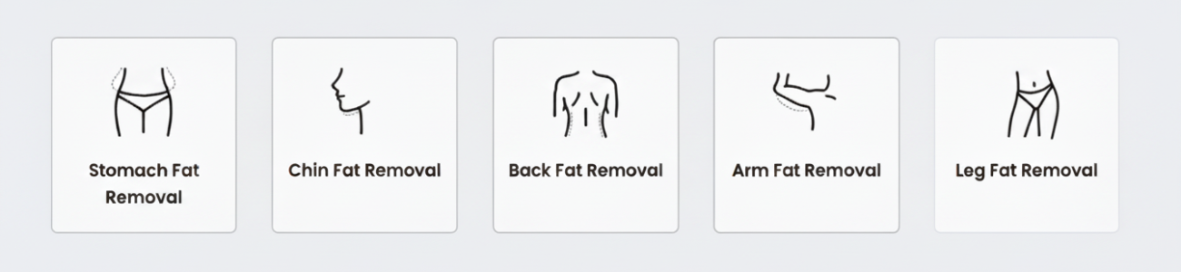 laser lipo procedure body areas